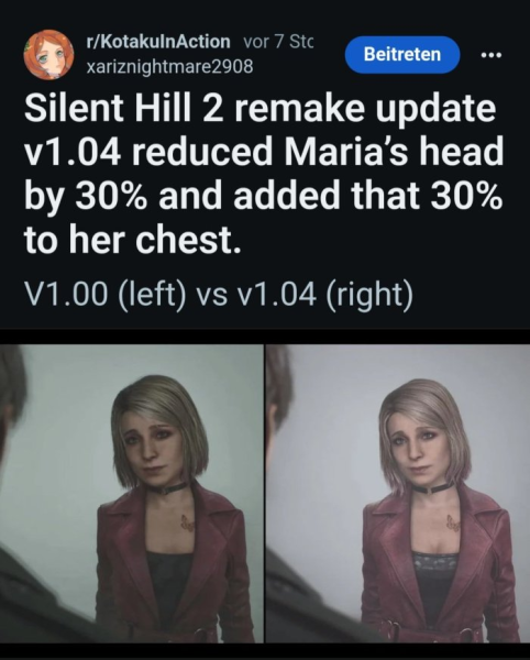 sh2boobs.png